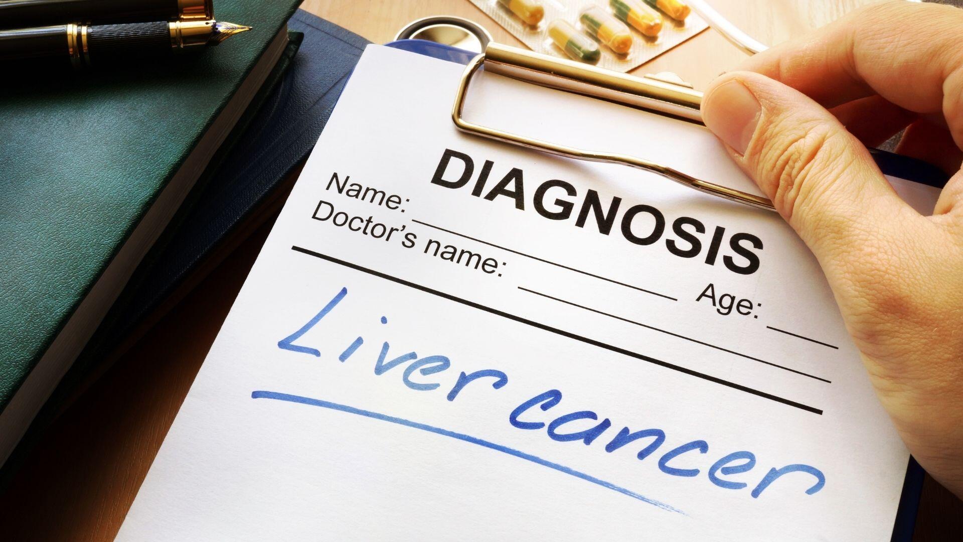 liver-cancer-treatment-options-washington-dc