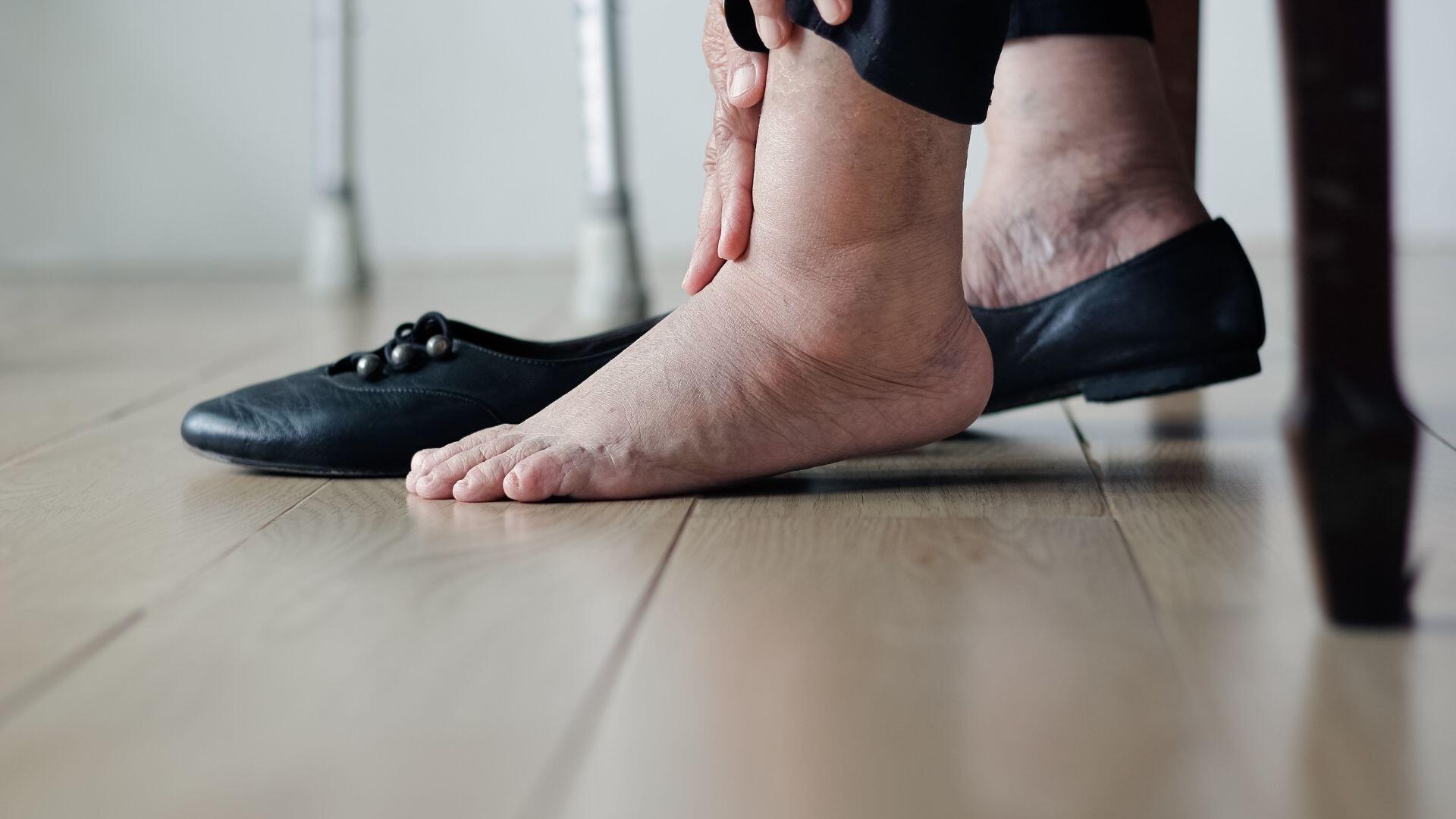 peripheral-artery-disease-pad-symptoms-sore-feet