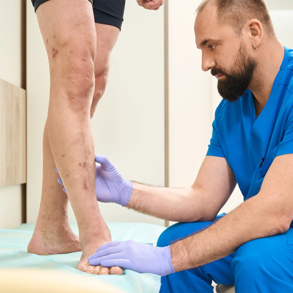 doctor-examining-legs-veins-1496927546_web