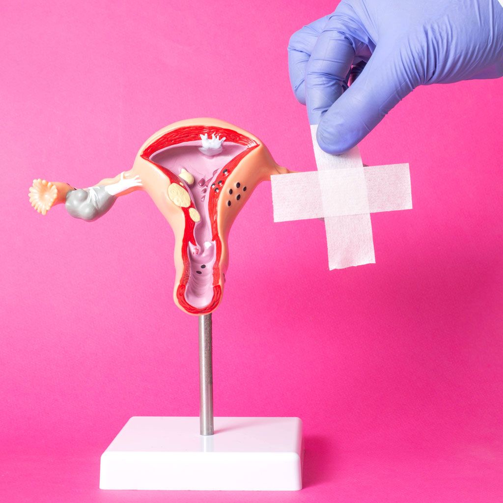 Uterus Model with Bandaid