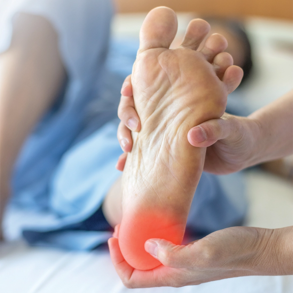 plantar fasciitis treatment