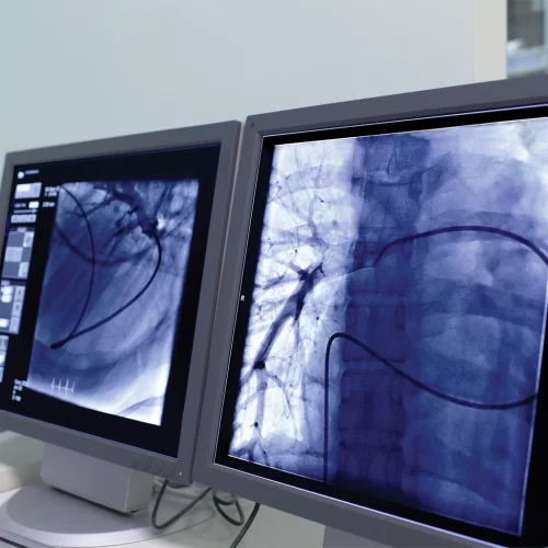 Interventional Radiology 537643147 Interventional Radiology 537643147