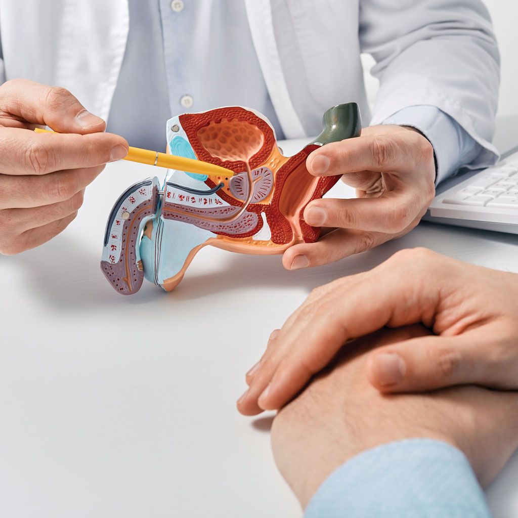 Sexual Side Effects of TURP vs PAE model