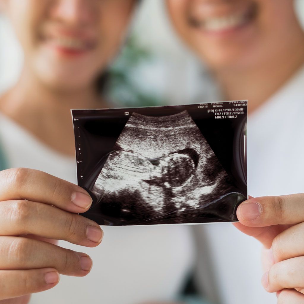 Can You Get Pregnant After Uterine Fibroid Embolization Ultrasound Image