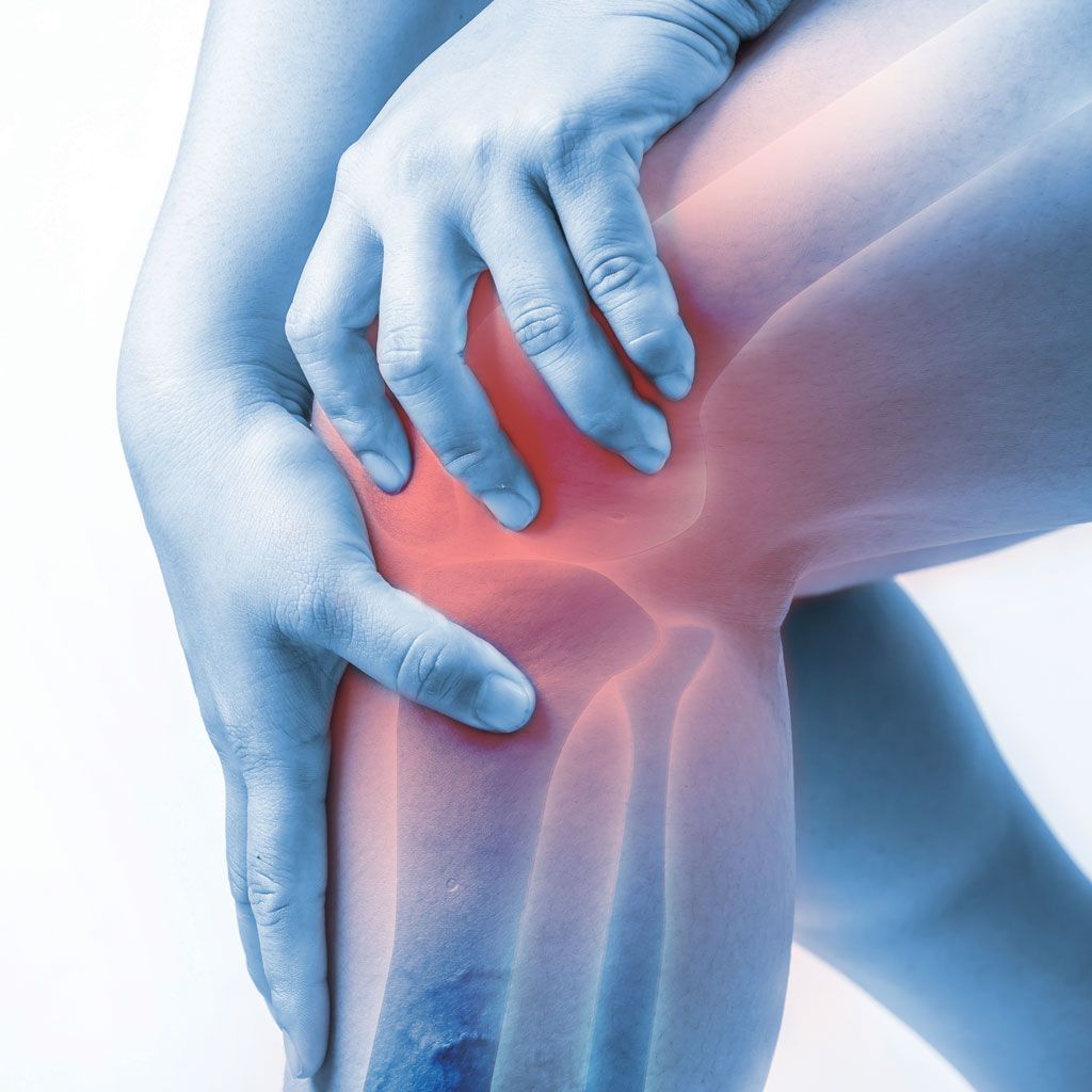 Genicular Artery Embolization for Knee Pain